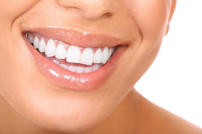 faccette estetiche