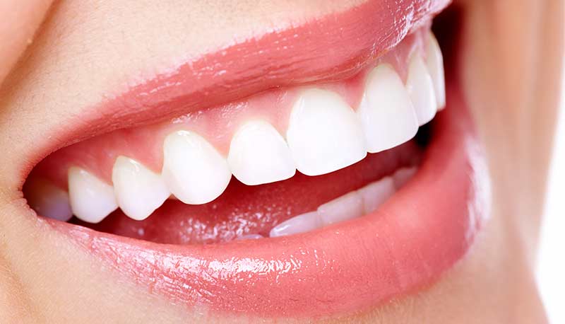 Il problema dei costi nei servizi odontoiatrici